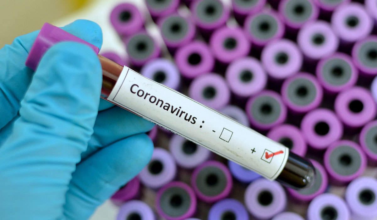 coronavirus