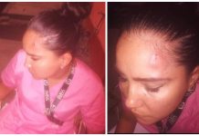 imss apodaca agresion
