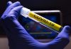 prueba-para-detectar-el-coronavirus-covid-19
