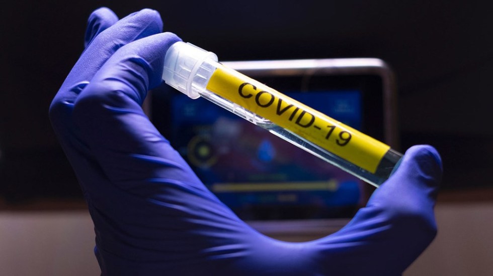 prueba-para-detectar-el-coronavirus-covid-19