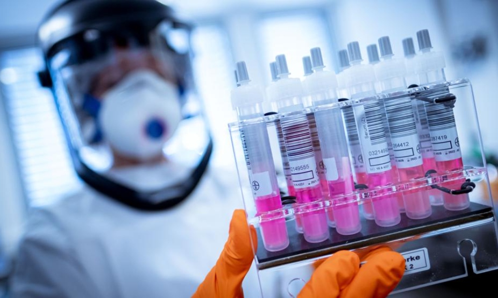 Laboratorio británico tendrá 30 millones de vacunas COVID-19 en septiembre